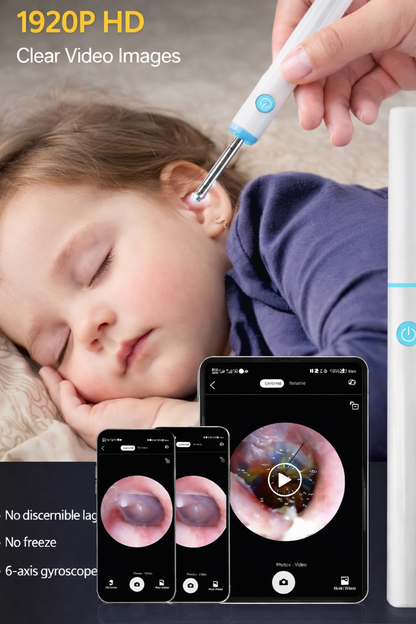 HD Ear Cleaning Camera Pen